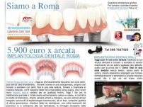 Implantologia dentale a Roma