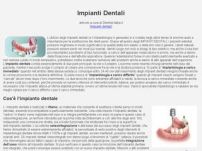 Impianti dentali