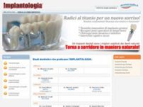 Implantologia Dentale